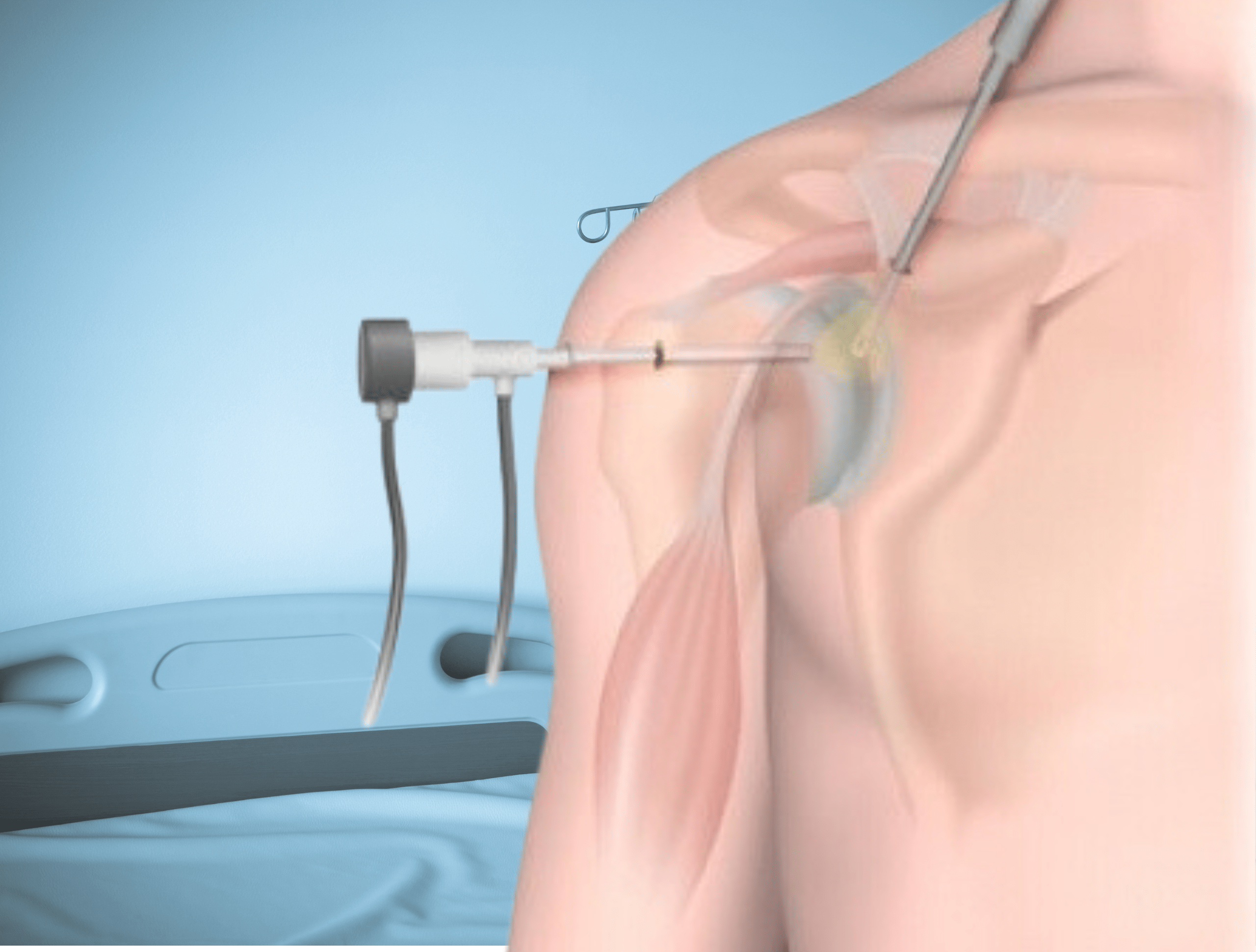 BNJ Arthroscopy Page (1)