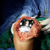 Dr Arindam Majumdar treatment