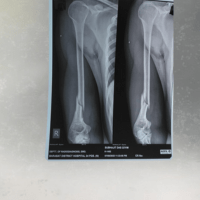 patient recovery 1
