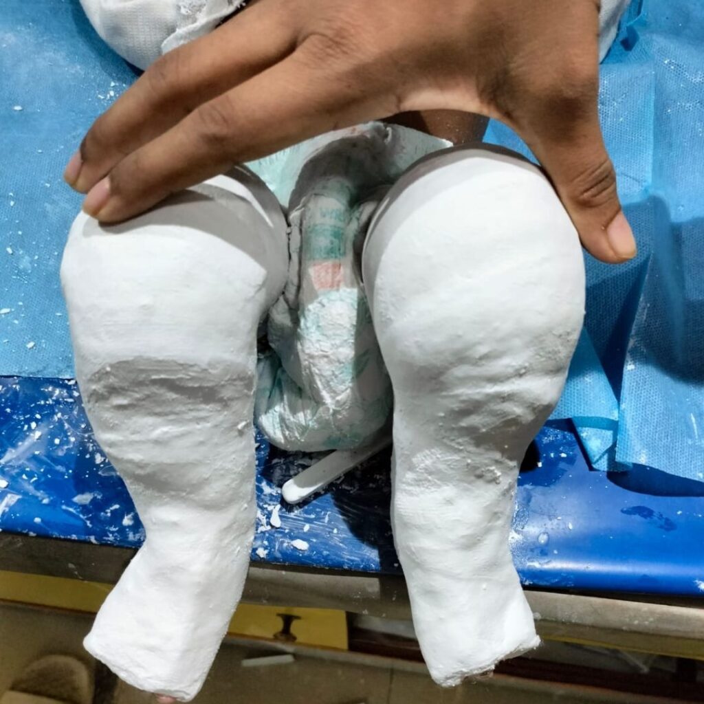 Best orthopaedic doctor in barasat.